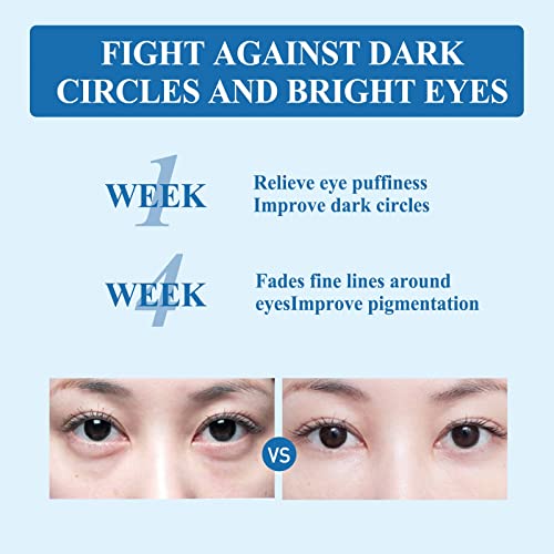 inodoz carmes yeys מעניקים לחות עיגולים כהים נשארים עד מאוחר תיקון קרמים עיניים מייצרים שקיות עיניים וקווים ללא שמן
